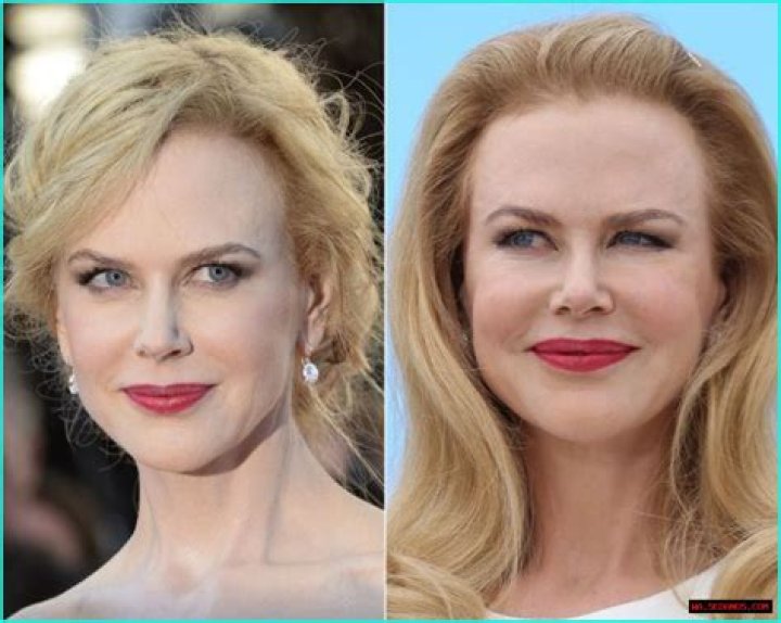 A Deeper Dive Into Her Journey Before Plastic Surgery