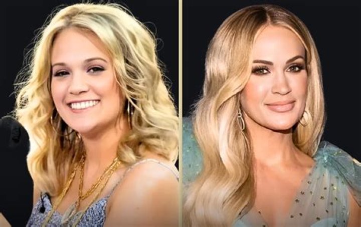 Carrie Underwood before and after plastic surgery Celebrity plastic