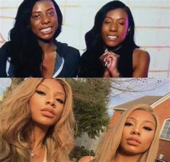 Clermont Twins BEFORE +AFTER 🤯
