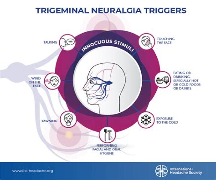 COVID-19's Impact On Trigeminal Neuralgia