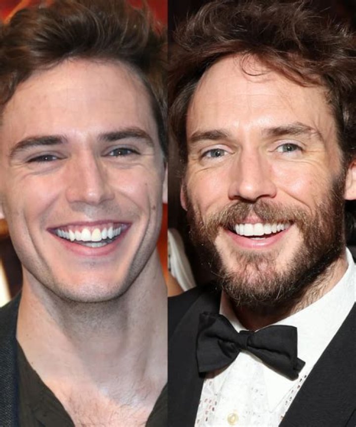 Did Sam Claflin Get Veneers? Here Are 14 Celebrities Before And After