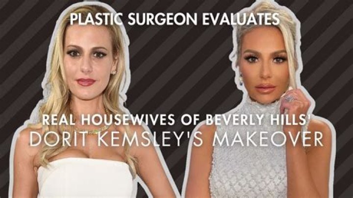 Has Dorit Kemsley Had Plastic Surgery? Body Measurements and More