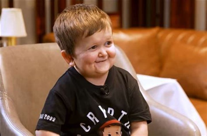 Hasbulla Magomedov Disability Parents And Net Worth