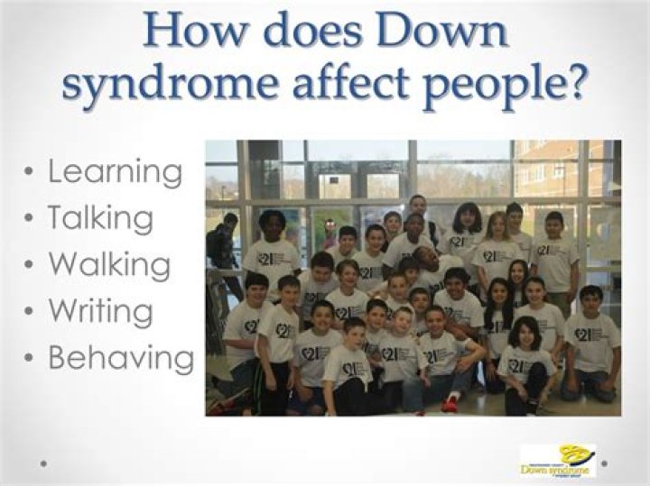 How Does Down Syndrome Affect Intellectual Development? Dane101