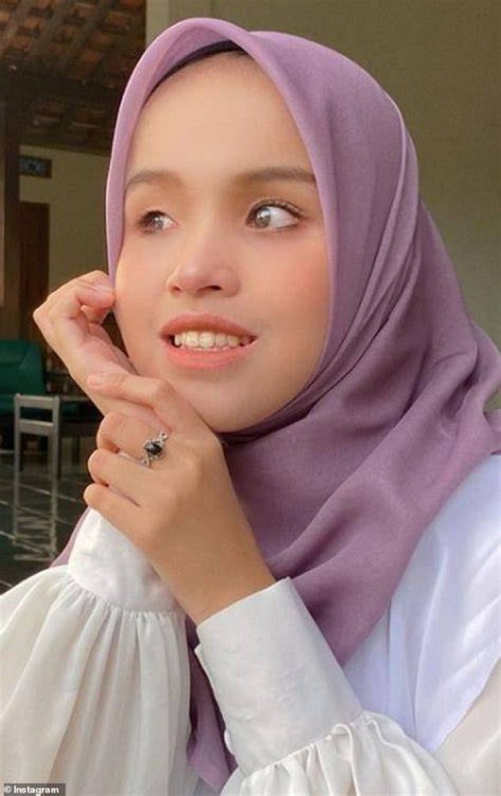 Is Putri Ariani Autistic? Illness And Mental Health Update 2023