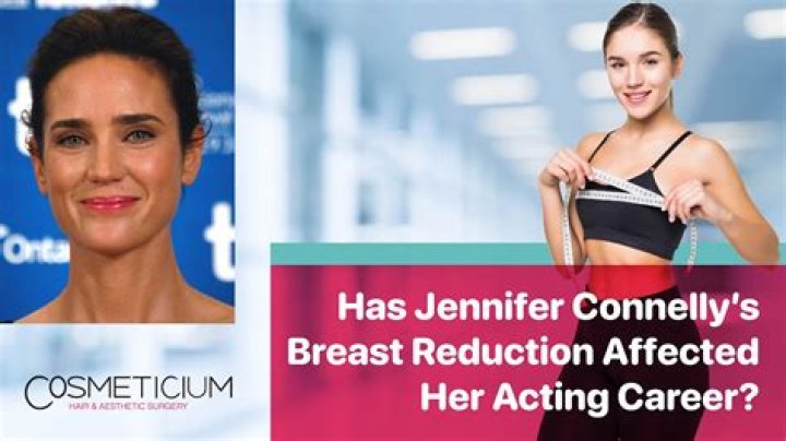 Jennifer Connelly Breast Reduction