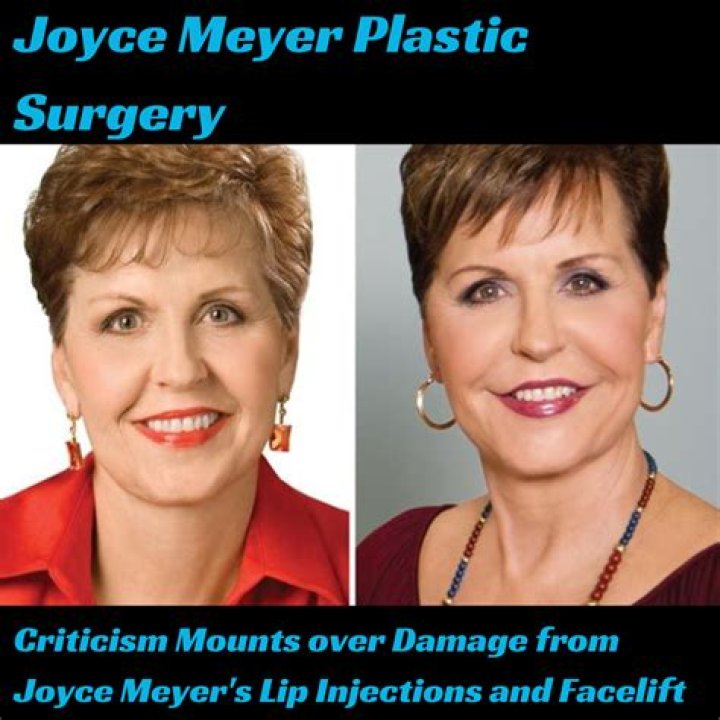 Joyce Meyer’s Plastic Surgery The Author/Speaker Has Never Admitted to