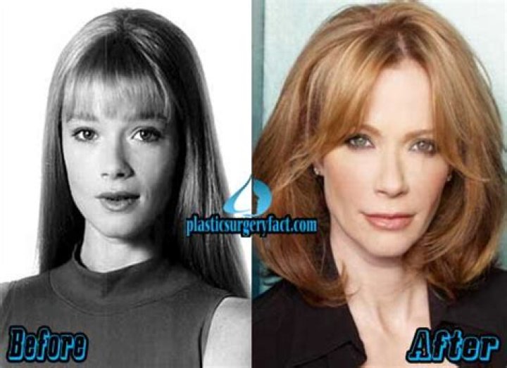 Lauren Holly Plastic Surgery Botox, Breast Increase, Nose Job