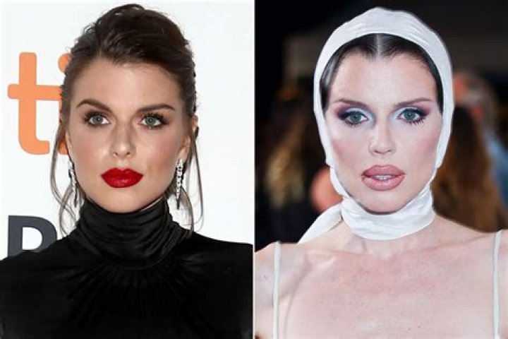 Maria Shriver’s Plastic Surgery No Longer Recognizable While Spotted