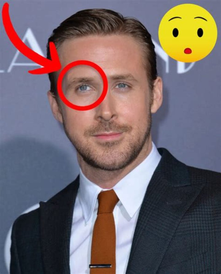 Pictures Celebrities with a Lazy Eye Celebrities With Amblyopia