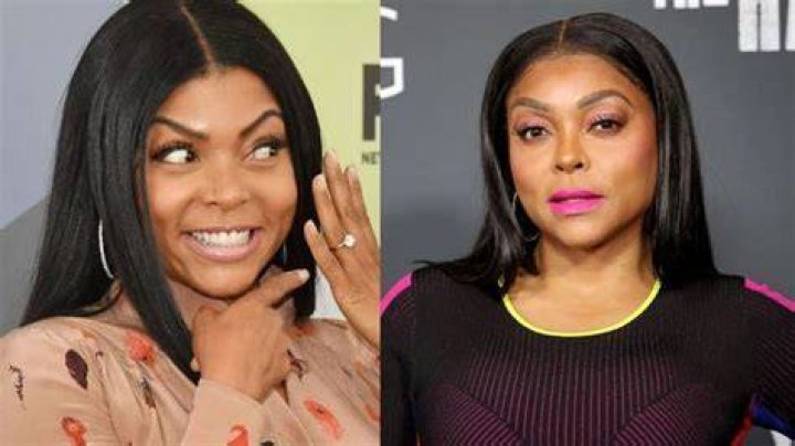Pin on Celebrity Plastic Surgery