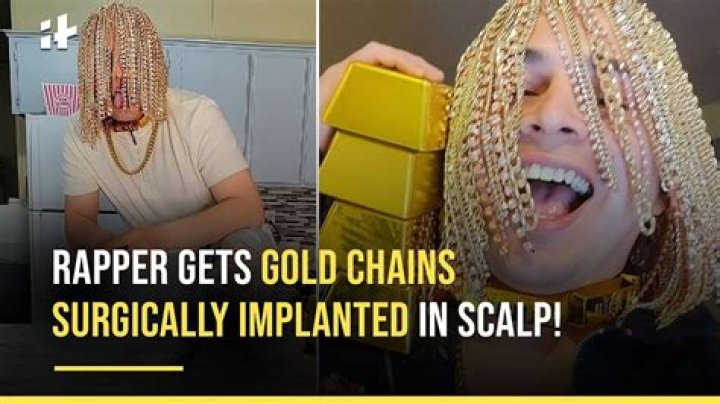 Rapper Dan Sur Gets Gold Chain Implanted Into His Head — Guardian Life