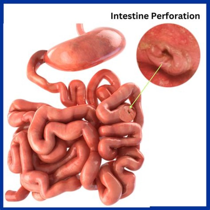 Sad News! Perforated stomach, Alan Jackson is currently on life support