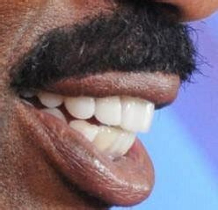 Steve Harvey Teeth Pictures