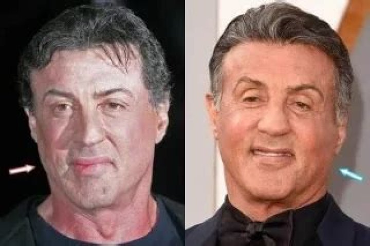 Sylvester Stallone Plastic Surgery Has Definitely Gone Wrong