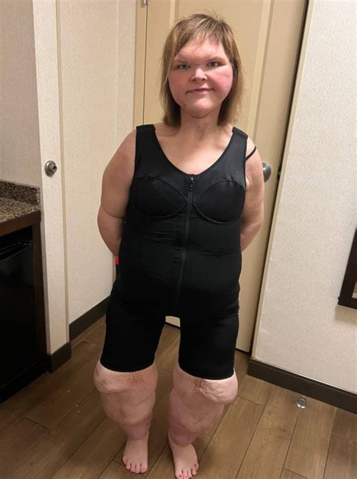 Tammy Slaton's Forehead Has Always Baffled '1000Lb Sisters' Fans