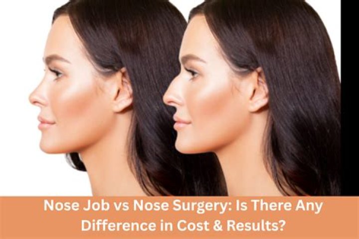 Tasha Smith Nose Job And Face Lift Before And After Photos