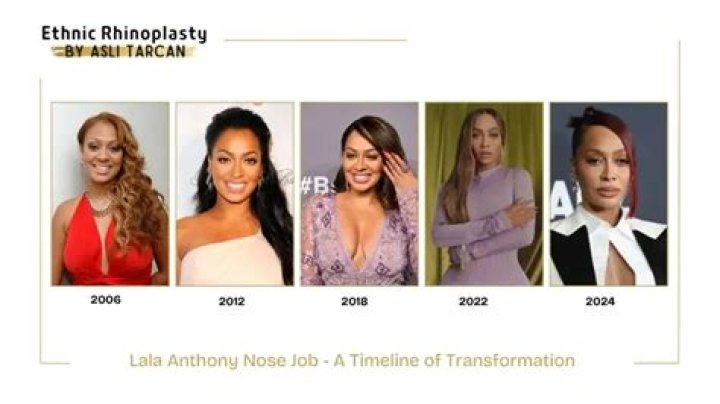 The Transformation of Lala Anthony Before and After Surgery
