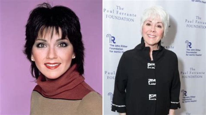 Uncover The Truth About Joyce Meyer's Facial Surgery: Discoveries And Insights