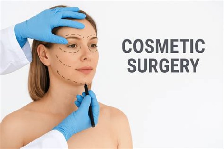 Uncovering Joyce Meyer's Cosmetic Surgery: Unveiling Insights And Surprises