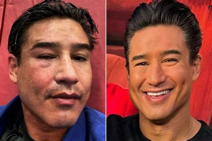 Unlock The Secrets Of Mario Lopez's Remarkable Health Journey