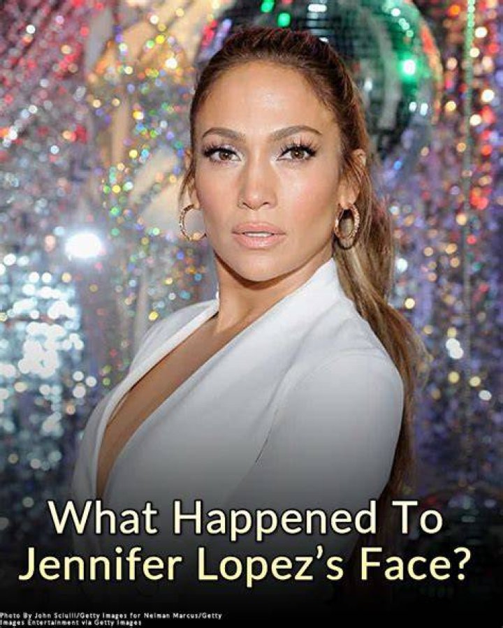 What Happened to Lopez Face? Did Lopez Cheat On His Wife