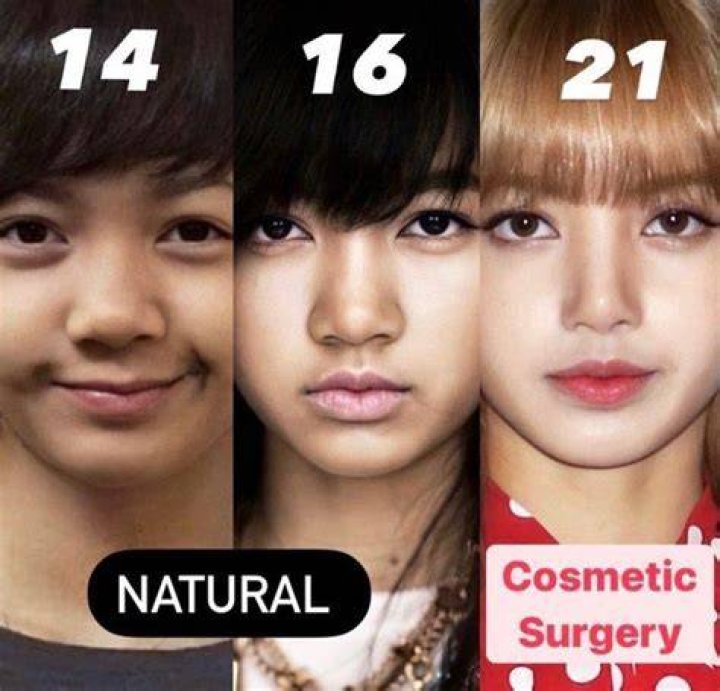What Plastic Surgery Has Lisa Boothe Done? Plastic Surgery Stars