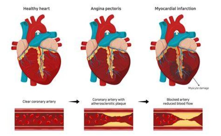 "Who Died On Duck Dynasty Of A Heart Attack" And Its Impact